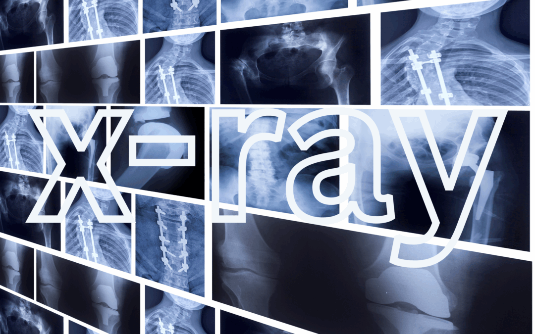 🩻 x-ray.Ai – Precision Imaging Meets Artificial Intelligence
